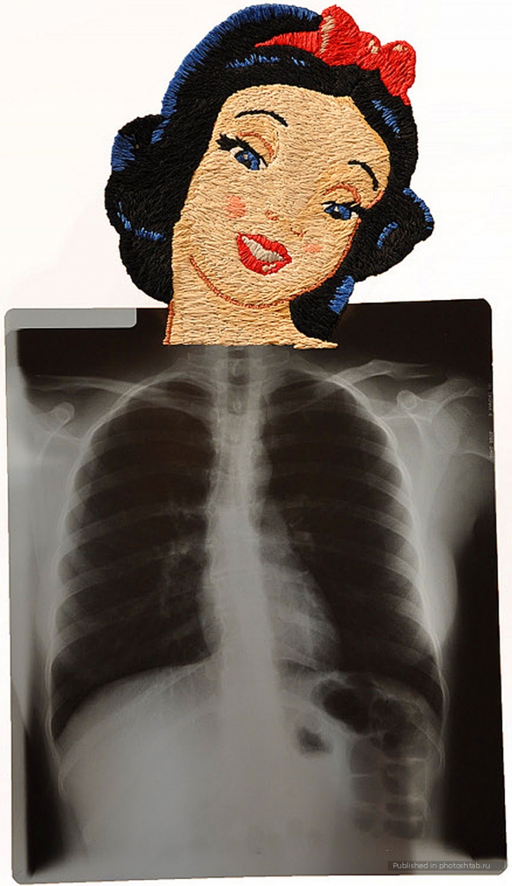 Вышитые рентгеновские снимки (подборка)