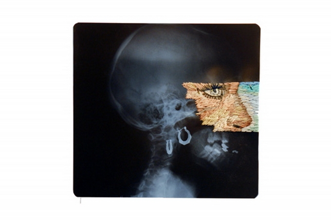 Вышитые рентгеновские снимки (подборка)